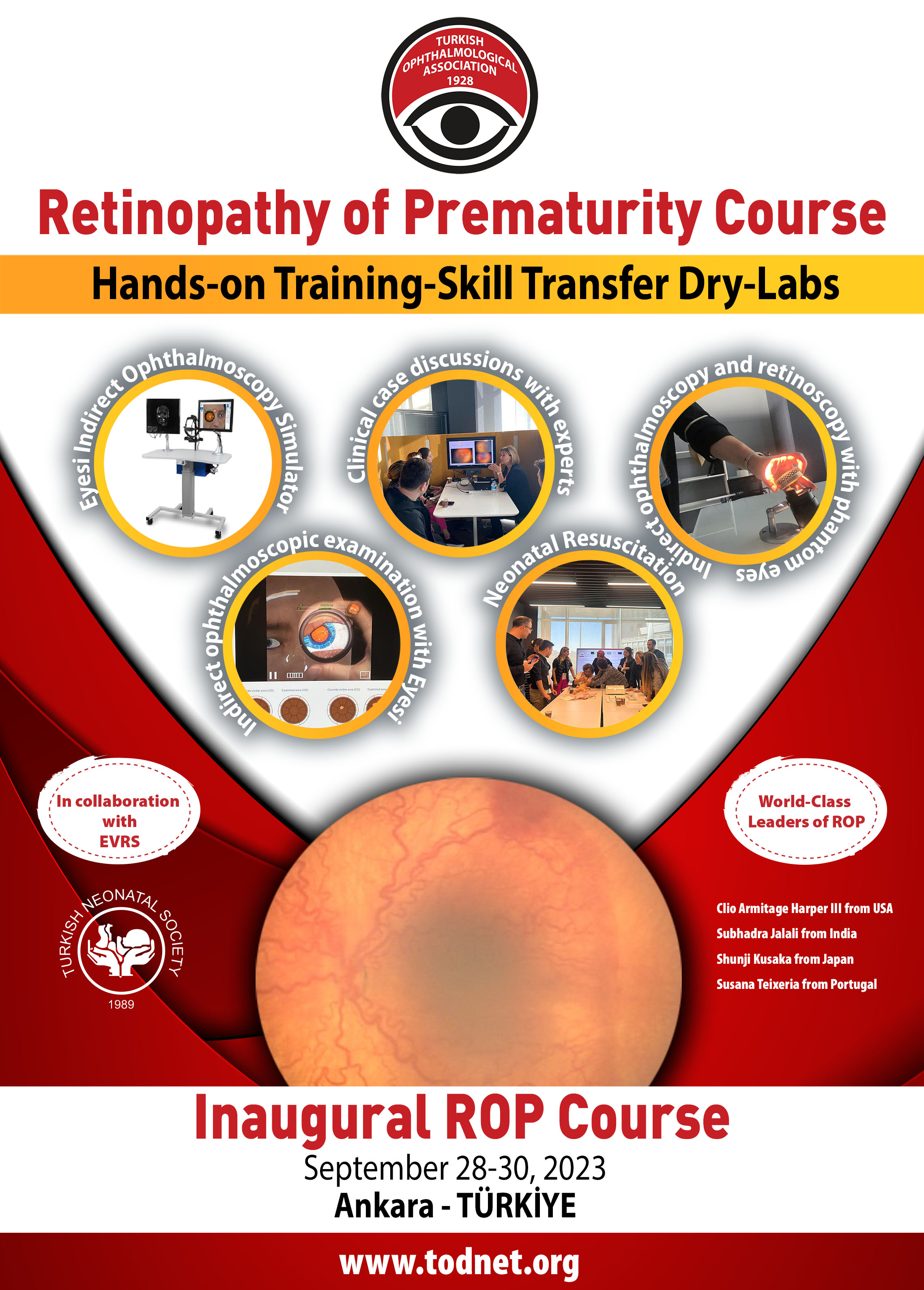 TOA Retinopathy of Prematurity Commission Skill Transfer Course